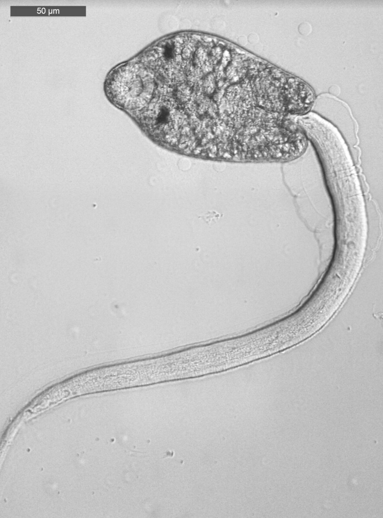 A microscopic image of a cercaria. It has a large flat head with a long skinny worm-like body.