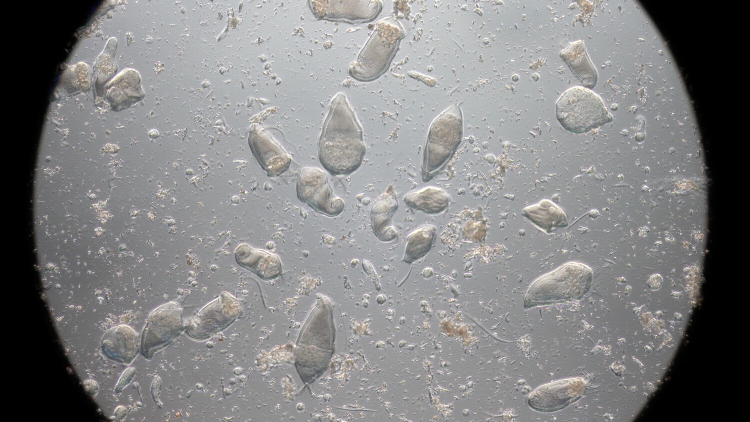 Looking through a microscope, transparent elongated blobs can be seen against a grey background.