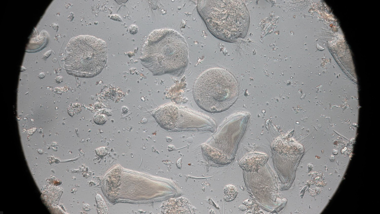 Looking through a microscope, transparent round blobs can be seen against a grey background. Jumbled material can be seen in their interiors.